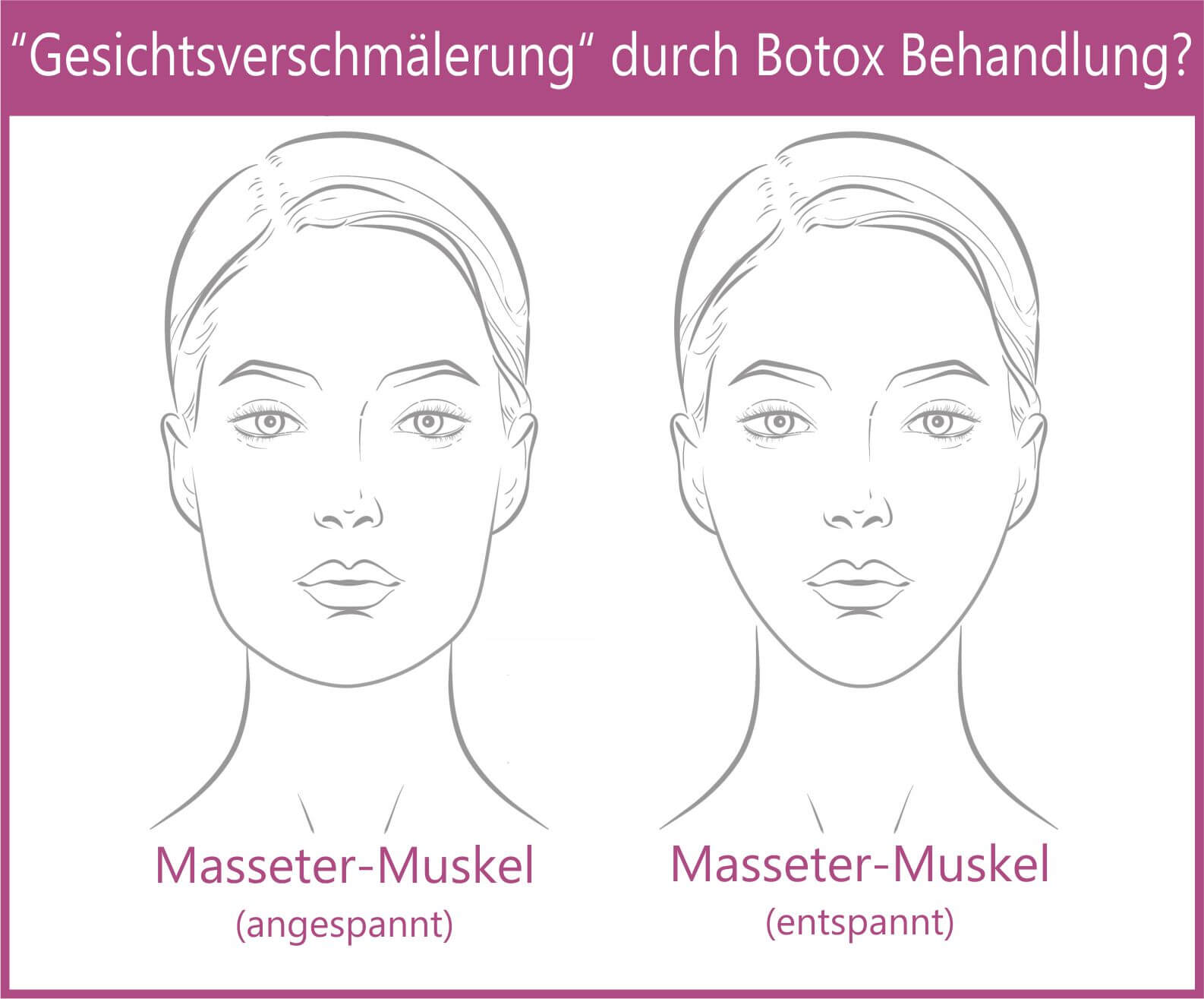 ss_botox